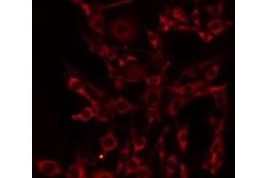 ABIN6275100 staining HeLa by IF/ICC. (CD39 antibody  (Internal Region))