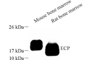Western blot analysis of ECP (ABIN7073838) at dilution of 1: 1000 (RNASE3 antibody)