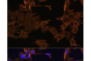 Immunofluorescence analysis of C6 cells using PDGFR beta Polyclonal Antibody at dilution of 1:100. (PDGFRB antibody)