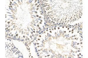 ABIN6257905 and ABIN6274686 at 1/100 staining Rat testis tissue by IHC-P. (Exonuclease 1 antibody  (N-Term))