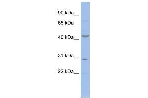 WB Suggested Anti-CCNE2 Antibody Titration:  0. (Cyclin E2 antibody  (N-Term))