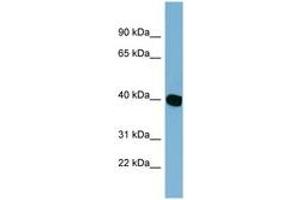 Image no. 1 for anti-Chromosome 14 Open Reading Frame 148 (C14orf148) (AA 179-228) antibody (ABIN6742128) (NOXRED1 antibody  (AA 179-228))