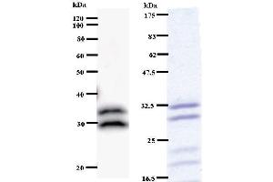 Left: C14orf172 staining. (TRMT61A antibody)