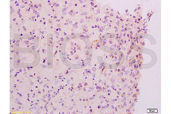 Muscarinic Acetylcholine Receptor M2 antibody  (AA 381-466)