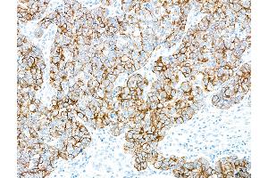 Immunohistochemistry (IHC) image for anti-Keratin 7 (KRT7) (C-Term) antibody (ABIN7453965)