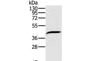 Western Blot analysis of Hela cell using PDSS2 Polyclonal Antibody at dilution of 1:200 (PDSS2 antibody)