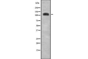 Western blot analysis of C/EBP ζ using COLO205 whole cell lysates (CEBPZ antibody  (N-Term))