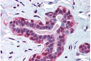 Human Breast (formalin-fixed, paraffin-embedded) stained with WRNIP1 antibody ABIN214570 at 3 ug/ml followed by biotinylated goat anti-rabbit IgG secondary antibody ABIN481713, alkaline phosphatase-streptavidin and chromogen. (WRNIP1 antibody  (AA 67-116))