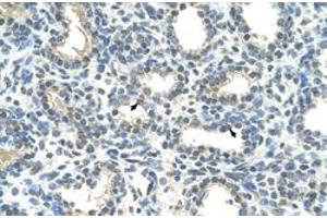 Immunohistochemical staining (Formalin-fixed paraffin-embedded sections) of human lung with HOXC9 polyclonal antibody  at 4-8 ug/mL working concentration. (HOXC9 antibody  (Internal Region))