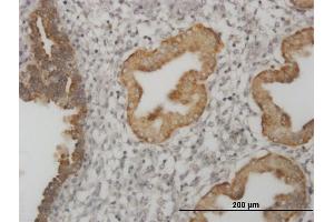 Immunoperoxidase of monoclonal antibody to MSI1 on formalin-fixed paraffin-embedded human endometrium. (MSI1 antibody  (AA 190-273))