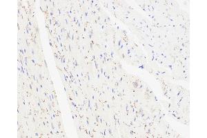 Immunohistochemistry analysis of paraffin-embedded mouse heart using Connexin 43 Polyclonal Antibody at dilution of 1:300. (Connexin 43/GJA1 antibody)