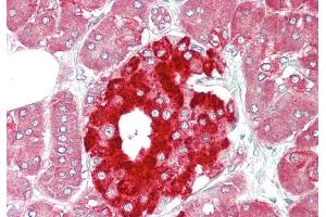 Rabbit Anti-PHGDH antibody Catalog Number: ARP54801 Formalin Fixed Paraffin Embedded Tissue: Human Pancreas Primary antibody Concentration: 1:100 Secondary Antibody: Donkey anti-Rabbit-Cy3 Secondary Antibody Concentration: 1:200 Magnification: 20x Exposure Time: 0. (PHGDH antibody  (Middle Region))