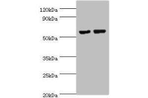 Western blot All lanes: MATN3 antibody at 14 μg/mL Lane 1: NIH/3T3 whole cell lysate Lane 2: Mouse thymus tissue Secondary Goat polyclonal to rabbit IgG at 1/10000 dilution Predicted band size: 53, 49 kDa Observed band size: 53 kDa