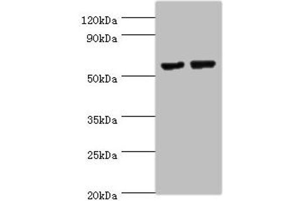 Matrilin 3 antibody  (AA 277-486)
