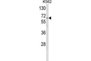 Western Blotting (WB) image for anti-Cytochrome P450, Family 4, Subfamily F, Polypeptide 3 (CYP4F3) antibody (ABIN3003849)