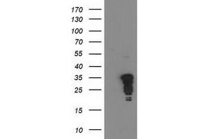 HEK293T cells were transfected with the pCMV6-ENTRY control (Left lane) or pCMV6-ENTRY JUN (Right lane) cDNA for 48 hrs and lysed. (C-JUN antibody)