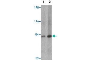 Western blot analysis of RBBP8 in mouse spleen tissue lysate with RBBP8 polyclonal antibody  at (1) 1 and (2) 2 ug/mL. (Retinoblastoma Binding Protein 8 antibody  (Internal Region))