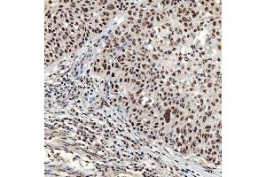 IHC analysis of SNRNP40 using anti-SNRNP40 antibody (ABIN7601719).