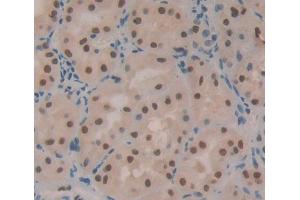 Used in DAB staining on fromalin fixed paraffin- embedded kidney tissue (TOPBP1 antibody  (AA 1-250))