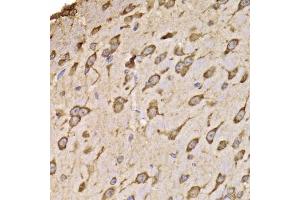 Immunohistochemistry of paraffin-embedded mouse brain using RPS14 antibody (ABIN5974066) at dilution of 1/100 (40x lens). (RPS14 antibody)