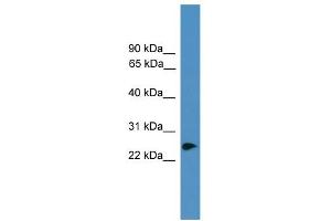 WB Suggested Anti-ZNF313 Antibody Titration:  0. (RNF114 antibody  (C-Term))