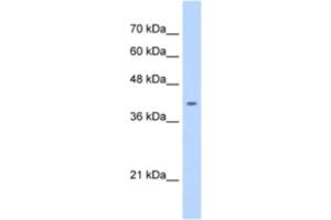 Western Blotting (WB) image for anti-ST6 (Alpha-N-Acetyl-Neuraminyl-2,3-beta-Galactosyl-1,3)-N-Acetylgalactosaminide alpha-2,6-Sialyltransferase 6 (ST6GALNAC6) antibody (ABIN2463033) (ST6GALNAC6 antibody)