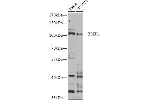 Western blot analysis of extracts of various cell lines, using ZBED1 Antibody (ABIN6132791, ABIN6150363, ABIN6150364 and ABIN6222539) at 1:1000 dilution. (ZBED1 antibody  (AA 1-280))