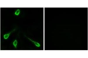 Immunofluorescence analysis of LOVO cells, using OR52E4 Antibody.