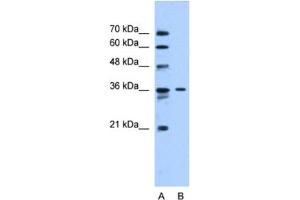 Western Blotting (WB) image for anti-Solute Carrier Family 35 (UDP-N-Acetylglucosamine (UDP-GlcNAc) Transporter), Member A3 (SLC35A3) antibody (ABIN2462748) (SLC35A3 antibody)