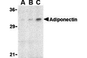 Western blot analysis of adiponectin in rat brain cell lysate with adiponectin antibody at (A) 1, (B) 2, and (C) 4 µg/mL. (ADIPOQ antibody  (N-Term))