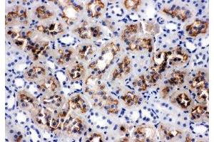 IHC-P: AQP1 antibody testing of rat kidney tissue (Aquaporin 1 antibody  (C-Term))