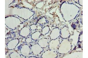 Immunohistochemistry of paraffin-embedded human thyroid tissue using ABIN7168881 at dilution of 1:100 (SDSL antibody  (AA 39-169))