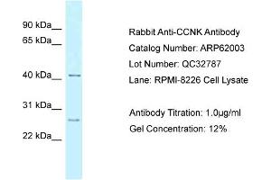Western Blotting (WB) image for anti-Cyclin K (CCNK) (Middle Region) antibody (ABIN970312) (Cyclin K antibody  (Middle Region))