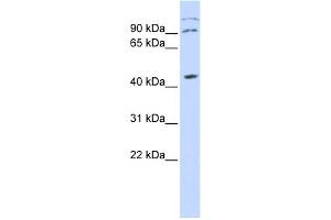 WB Suggested Anti-ZFX Antibody Titration:  0. (ZFX antibody  (Middle Region))