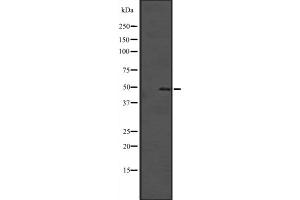 Western blot analysis of SOX4 expression in Hela cell lysate,The lane on the left is treated with the antigen-specific peptide. (SOX4 antibody  (C-Term))