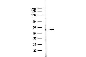 Western blot analysis of lysates from F10-LUC cells(heat-shock, 45 min treatment), using AP1M1 Antibody at 1/1000 dilution.