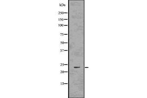 RAB10 antibody  (C-Term)