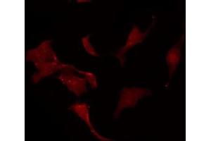 Immunofluorescence (fixed cells) (IF/ICC) image for anti-Potassium Voltage-Gated Channel, Shaw-Related Subfamily, Member 1 (KCNC1) (C-Term) antibody (ABIN6258309)
