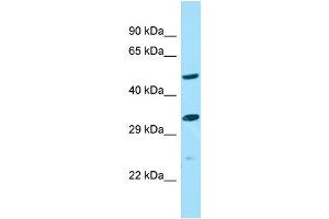WB Suggested Anti-ALG10B Antibody Titration: 1. (ALG10B antibody  (Middle Region))