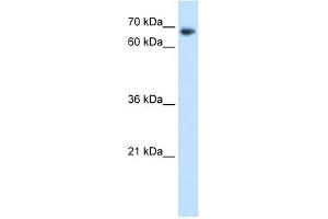 WB Suggested Anti-TAF6 Antibody Titration:  1. (TAF6 antibody  (N-Term))
