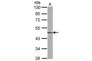 Zinc Finger and SCAN Domain Containing 31 (ZSCAN31) (AA 66-379) antibody