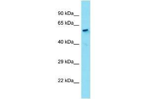 Host:  Rabbit  Target Name:  HDAC1  Sample Type:  Liver Tumor lysates  Antibody Dilution:  1. (HDAC1 antibody  (N-Term))