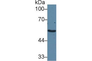 Western Blot; Sample: Human Liver lysate; Primary Ab: 2µg/ml Rabbit Anti-Human ADRa1A Antibody Second Ab: 0. (alpha 1 Adrenergic Receptor antibody  (AA 330-466))