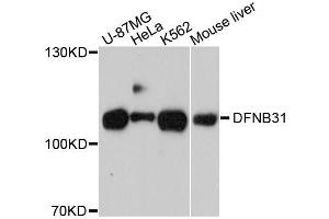 Western blot analysis of extracts of various cell lines, using WHRN antibody. (DFNB31 antibody  (AA 708-907))