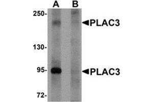Western blot analysis of PLAC3 in HeLa cell lysate with PLAC3 antibody at 1 μg/ml in (A) the absence and (B) the presence of blocking peptide. (PAPPA2 antibody  (N-Term))