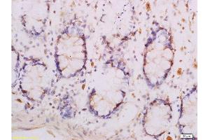 Formalin-fixed and paraffin embedded human rectal tissue labeled with Anti-Adiponectin Receptor 1 Polyclonal Antibody , Unconjugated at 1:300, followed by conjugation to the secondary antibody and DAB staining (Adiponectin Receptor 1 antibody  (AA 241-270))