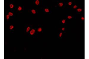 ABIN6269018 staining COS7 by IF/ICC. (HDAC10 antibody)