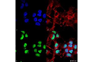 Immunocytochemistry/Immunofluorescence analysis using Rabbit Anti-Choline Acetyltransferase Polyclonal Antibody . (Choline Acetyltransferase antibody  (N-Term) (HRP))