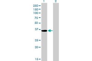 Western Blot analysis of GSC expression in transfected 293T cell line by GSC monoclonal antibody (M03), clone 3D11.