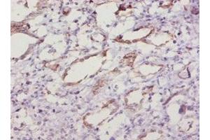 Immunohistochemistry of paraffin-embedded human kidney tissue using ABIN7177879 at dilution of 1:10 (SOD1 antibody  (AA 2-154))
